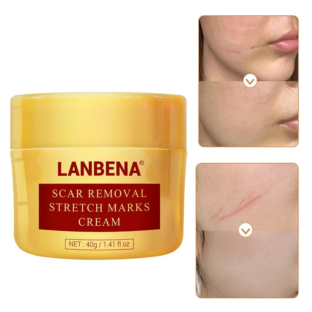 Lanbena Scar Removel Stretch Marks Cream (40g)