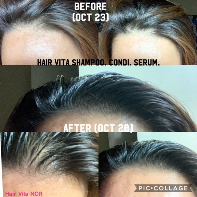 Hair Vita Hair Grower Serum